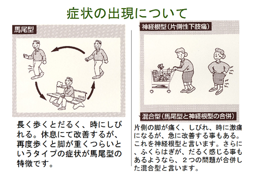 症状の出現について