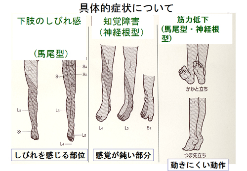 具体的症状について