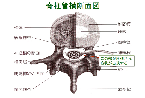 脊柱管横断面図