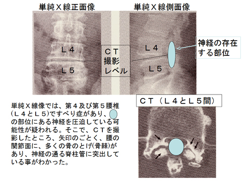 単純Ｘ線正面像・側面像