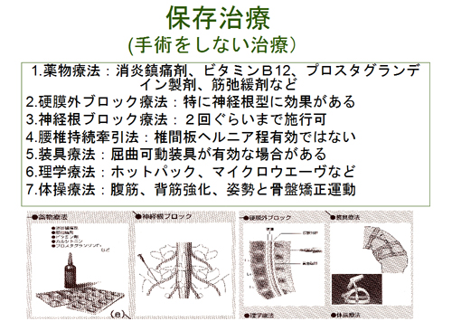 保存治療