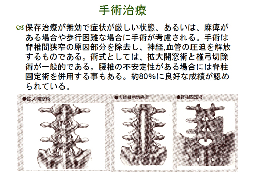 手術治療